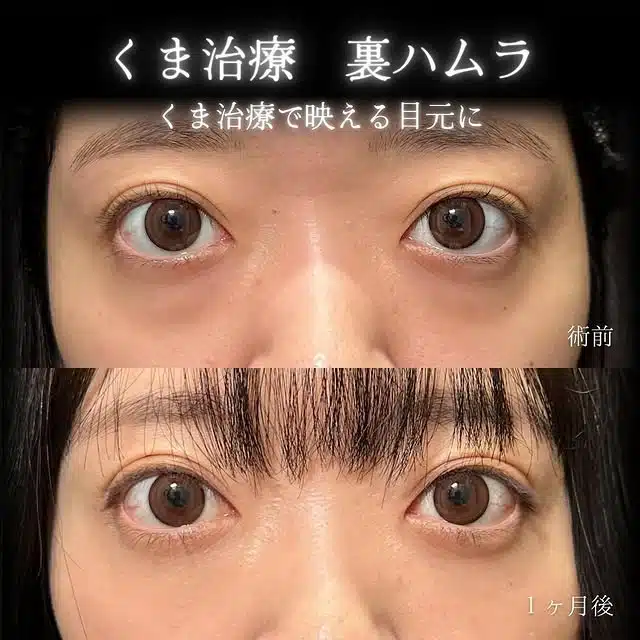 クマ取り 裏ハムラ 仙台