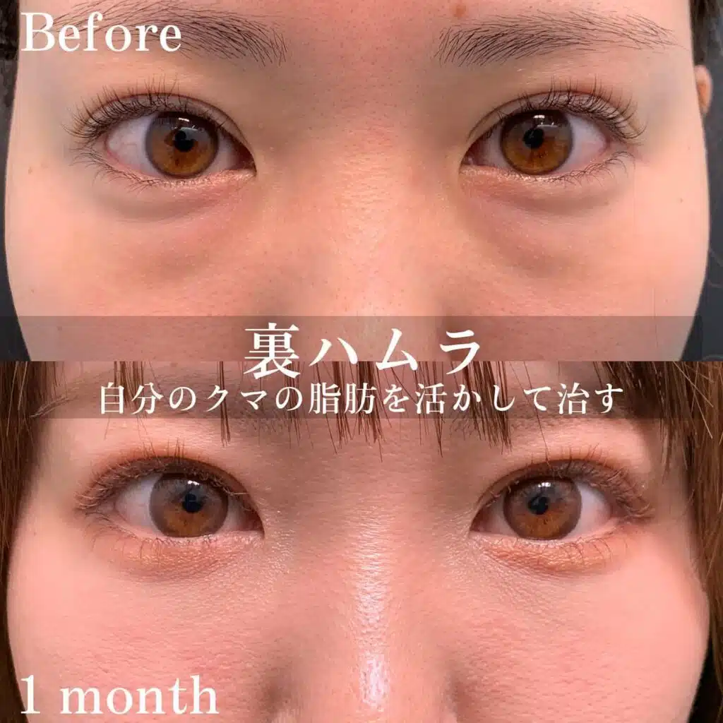 裏ハムラ 仙台