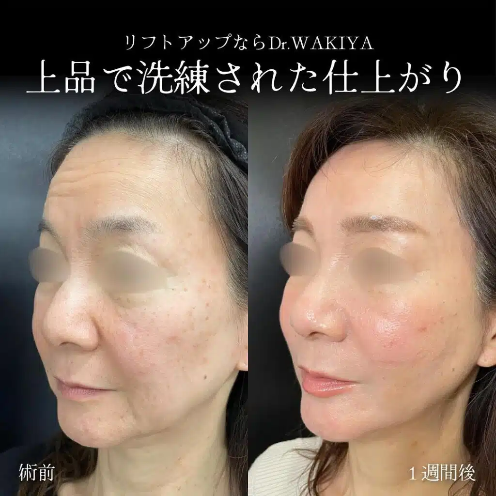 上品で洗練された仕上がり 仙台