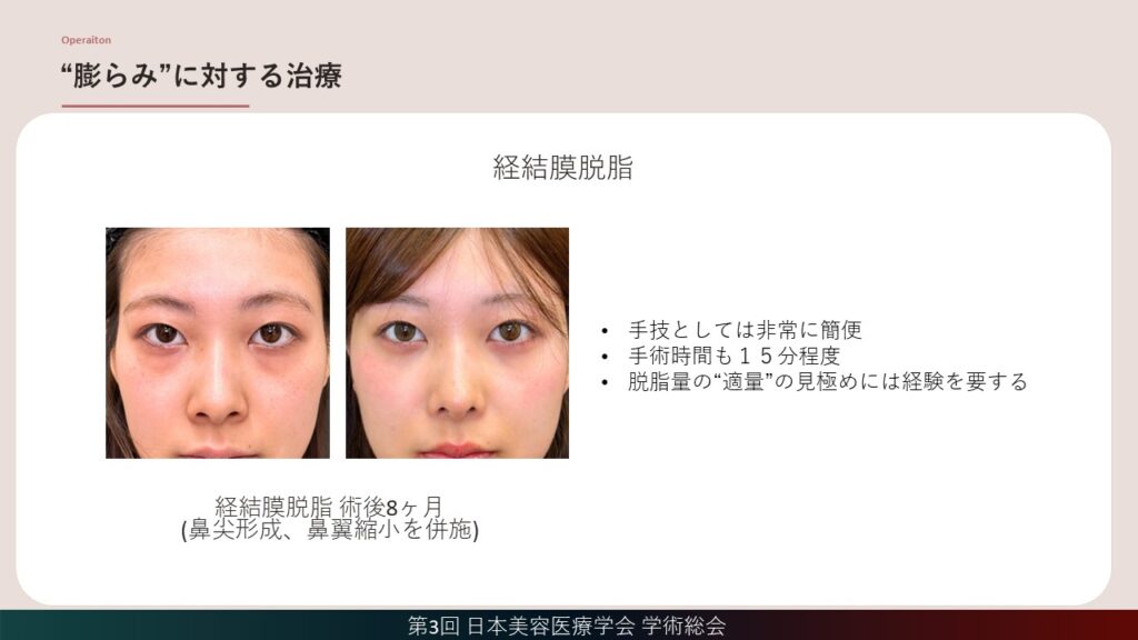 16_クマの診察で必ず確認したいポイント